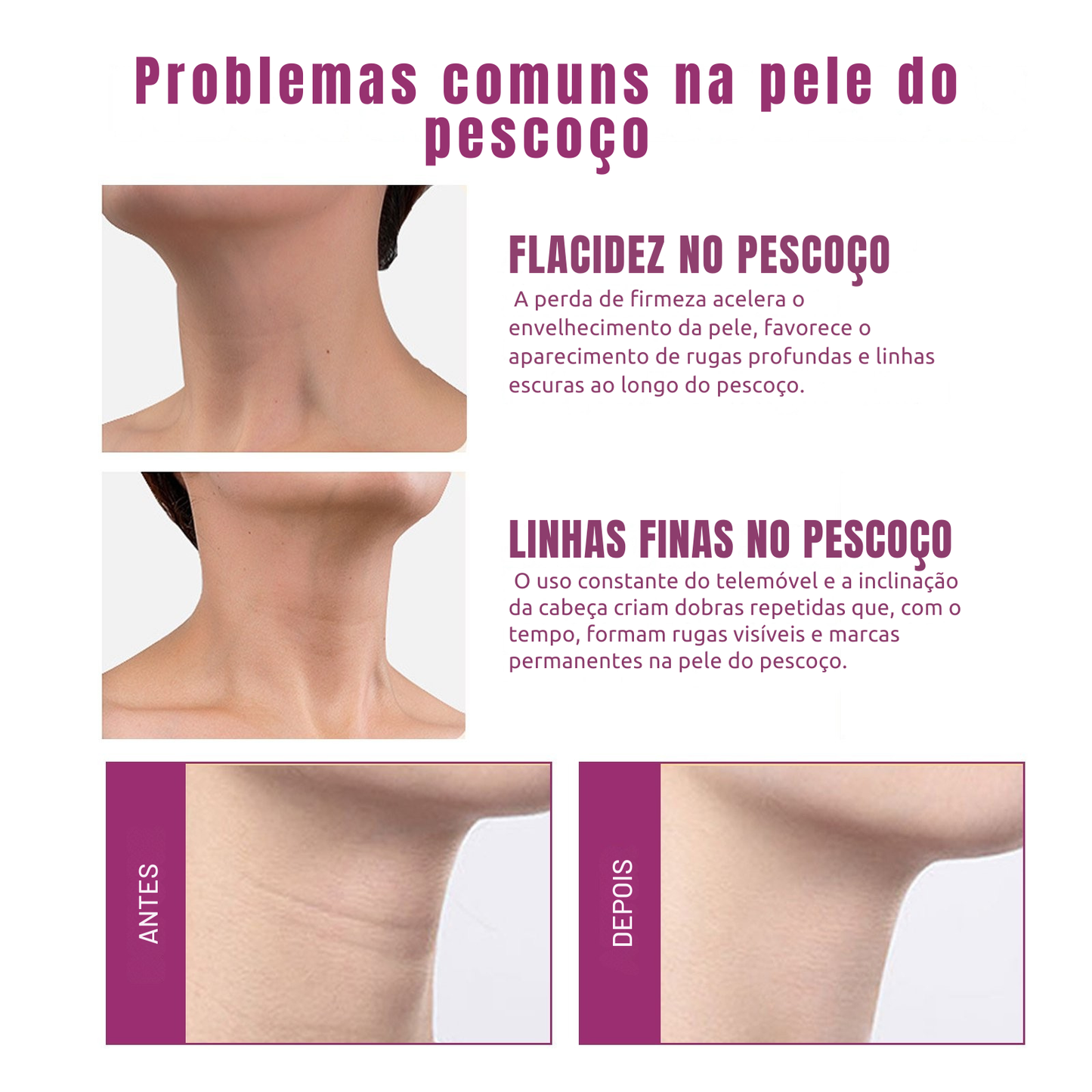 JAYSUING Crema para el cuello con colágeno hidrolizado