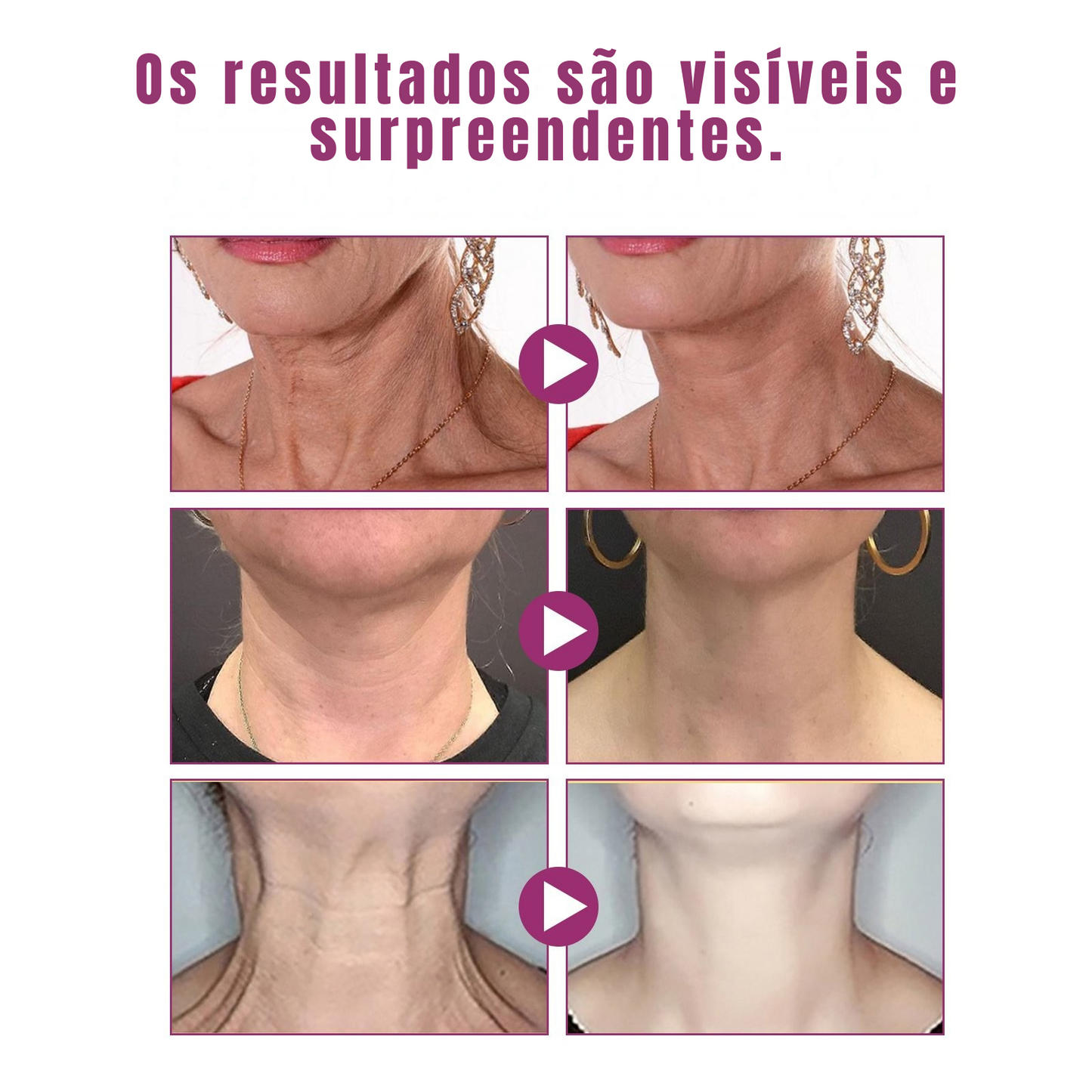 JAYSUING Crema para el cuello con colágeno hidrolizado